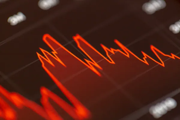 Apprendre le Trading et la Bourse 2026 : Guide D&eacute;butant